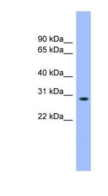 Polyclonal Rabbit anti-Human ENOPH1 / MASA Antibody (aa35-84, WB)