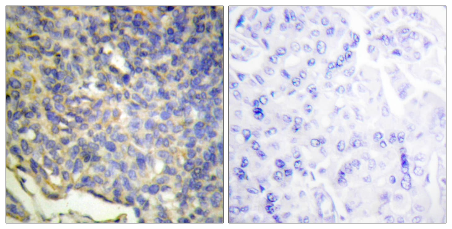 DFFA / ICAD / DFF45 Antibody (aa151-200)