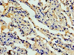 CCL11 / Eotaxin Antibody (aa1-97)