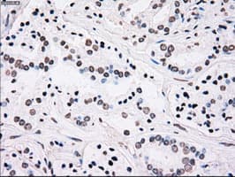 PLK1 / PLK-1 Antibody (clone OTI1D4)