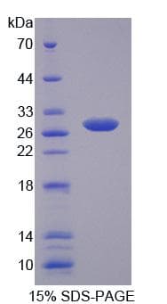 Human MYT1 Protein (Recombinant)