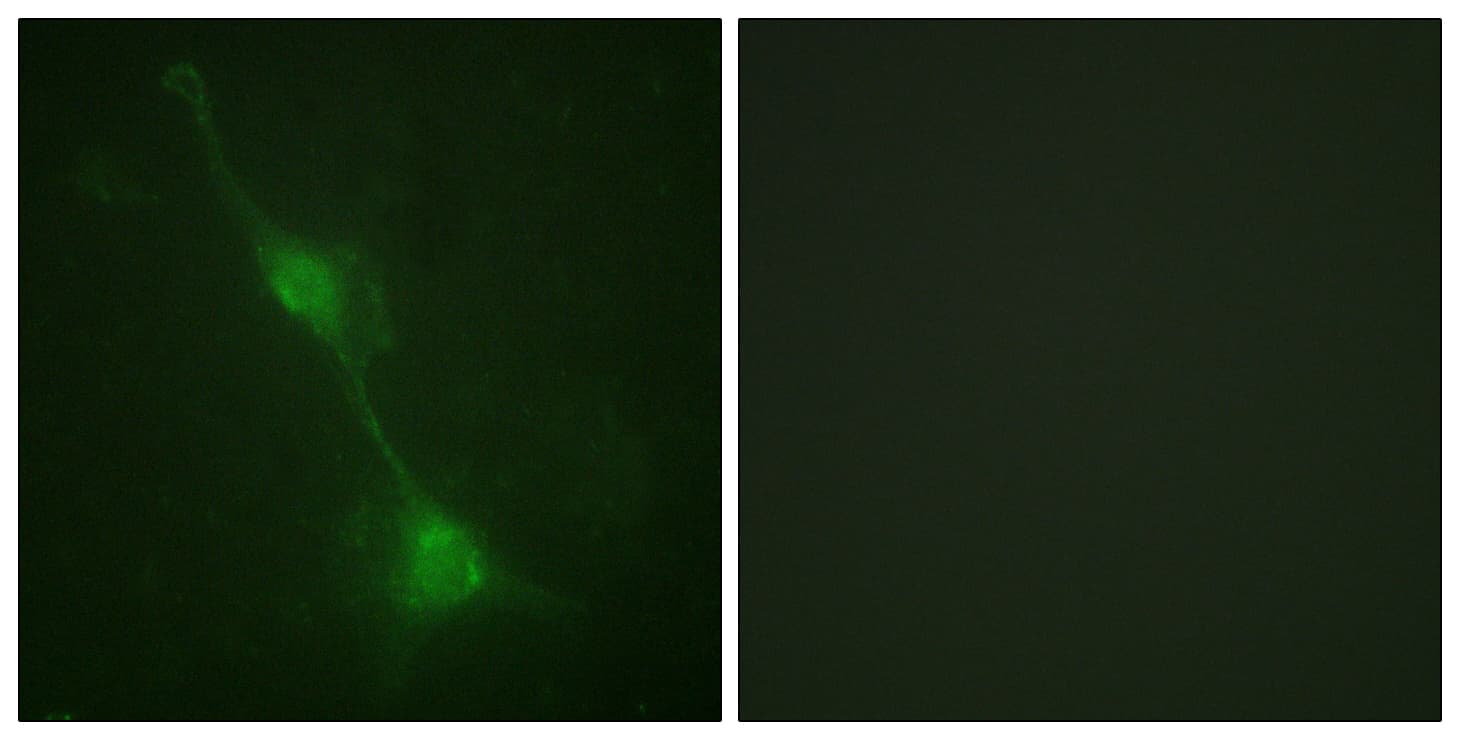 IHC-plus™ ATXN1 / SCA1 Antibody (aa742-791)