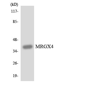 IHC-plus™ Polyclonal Rabbit anti-Human MRGPRX4 / MRGX4 Antibody (aa258-307, IHC, WB)