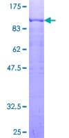 Human PRC1 Protein (Recombinant GST)
