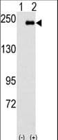 Polyclonal Rabbit anti-Human SPAG9 Antibody (aa91-120, IHC, WB)