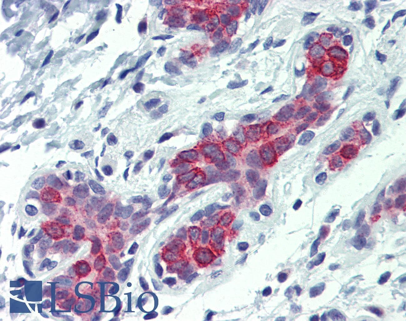 IHC-plus™ BAK1 / BAK Antibody