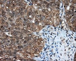 LIPG / Endothelial Lipase Antibody (clone OTI4A8)