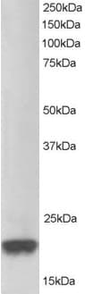 IHC-plus™ PARK7 / DJ-1 Antibody (aa178-189)