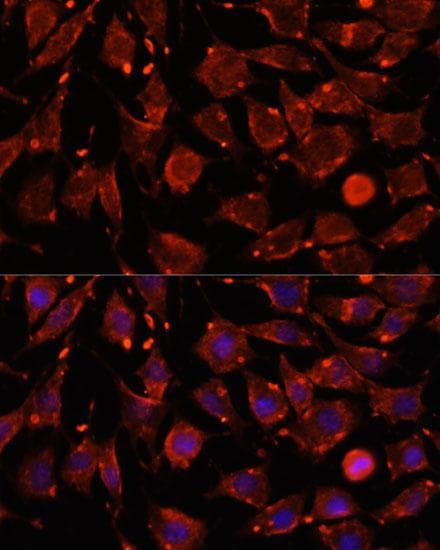 Polyclonal Rabbit anti-Human ITSN2 Antibody (IF, WB)