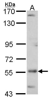 Polyclonal Rabbit anti-Human ADCK4 Antibody (aa231-544, WB)