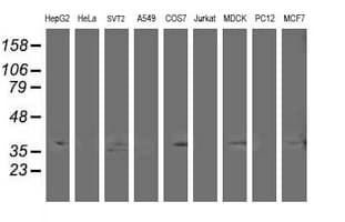 HDHD2 Antibody (clone OTI1A4, Carrier-free)