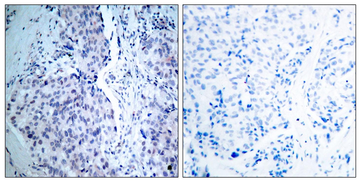 Polyclonal Rabbit anti-Human RB1 / Retinoblastoma / RB Antibody (p807, IHC, WB)