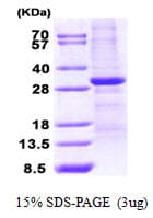 Human WWOX Protein (Recombinant His)