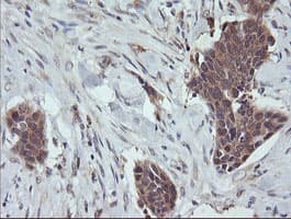 TCL / RHOJ Antibody (clone OTI2C9)