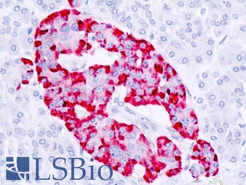 IHC-plus™ Polyclonal Rabbit anti-Human CPE / Carboxypeptidase E Antibody (aa271-320, IHC, WB)