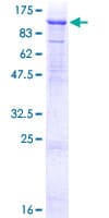 Human NEK8 Protein (Recombinant GST)
