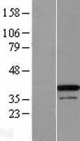 ZC3H8 Protein (Over-Expression Lysate Myc-DDK (Flag))