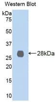 LOXL2 Antibody (aa544-751, PE)