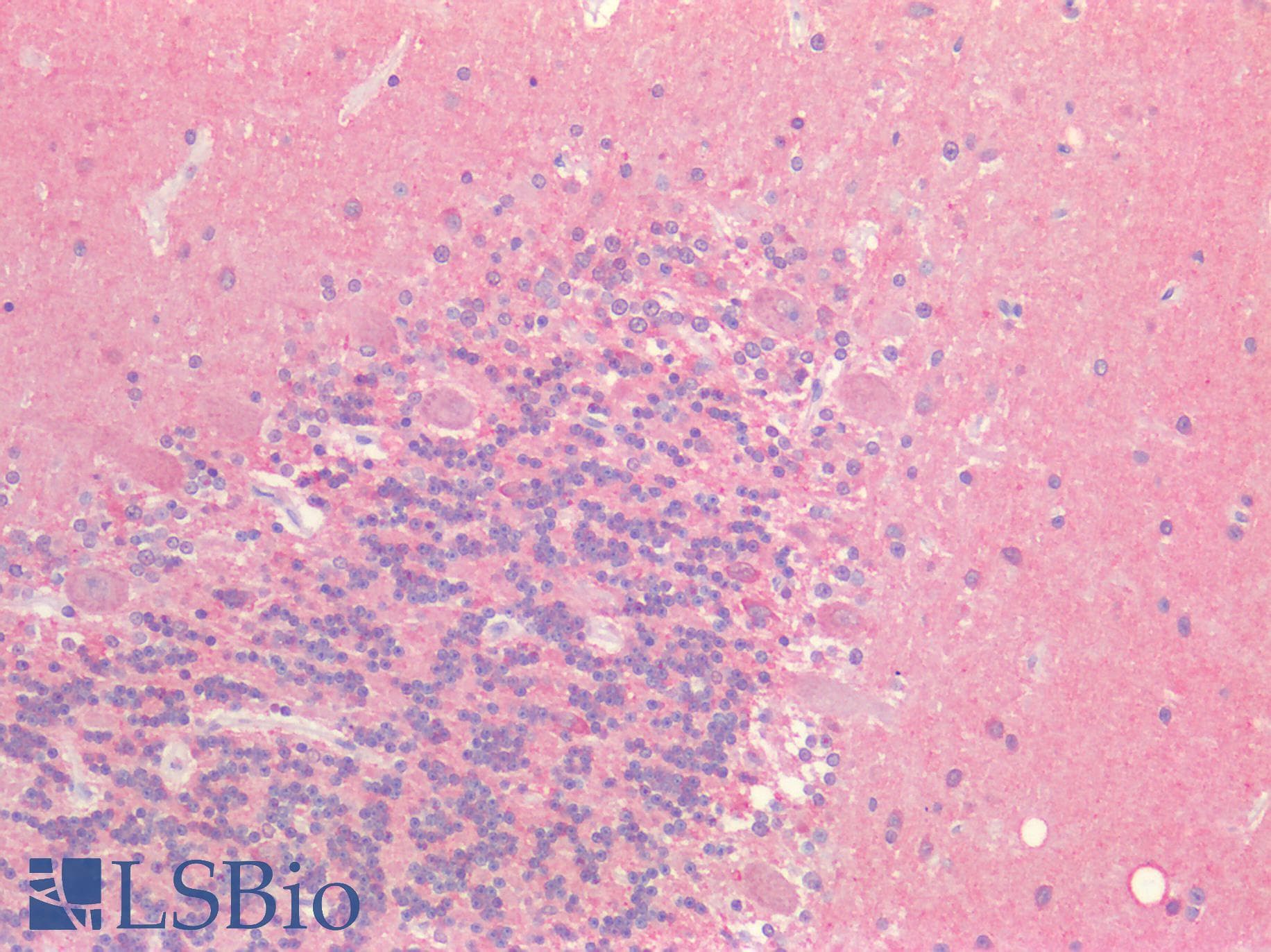 PathPlus™ Polyclonal Rabbit anti-Human MAPT / Tau Antibody (IHC, WB)