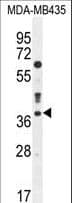 CASP3 / Caspase 3 Antibody (aa219-248)