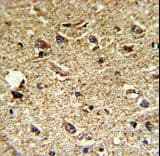 CCRN4L / Nocturnin Antibody (aa309-336)