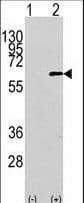 Polyclonal Rabbit anti-Human AKT1 Antibody (aa115-144, IHC, IF, WB)