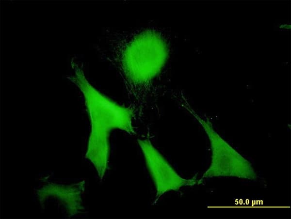 GAS2 Antibody (clone 4E11)