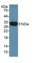 ALDOA / Aldolase A Antibody