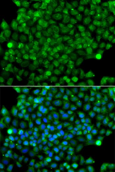 IHC-plus™ CFHR3 / CFHL3 Antibody