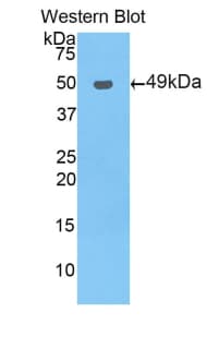 NR1I2 / PXR Antibody (aa246-431)