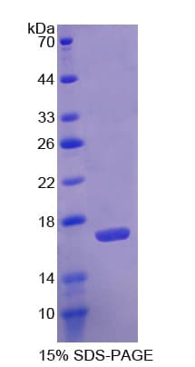 Human AGMAT Protein (Recombinant His)