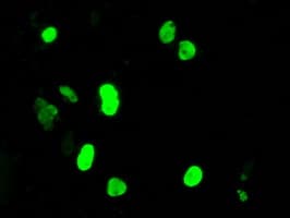DNTTIP1 / TDIF1 Antibody (clone OTI1E2)