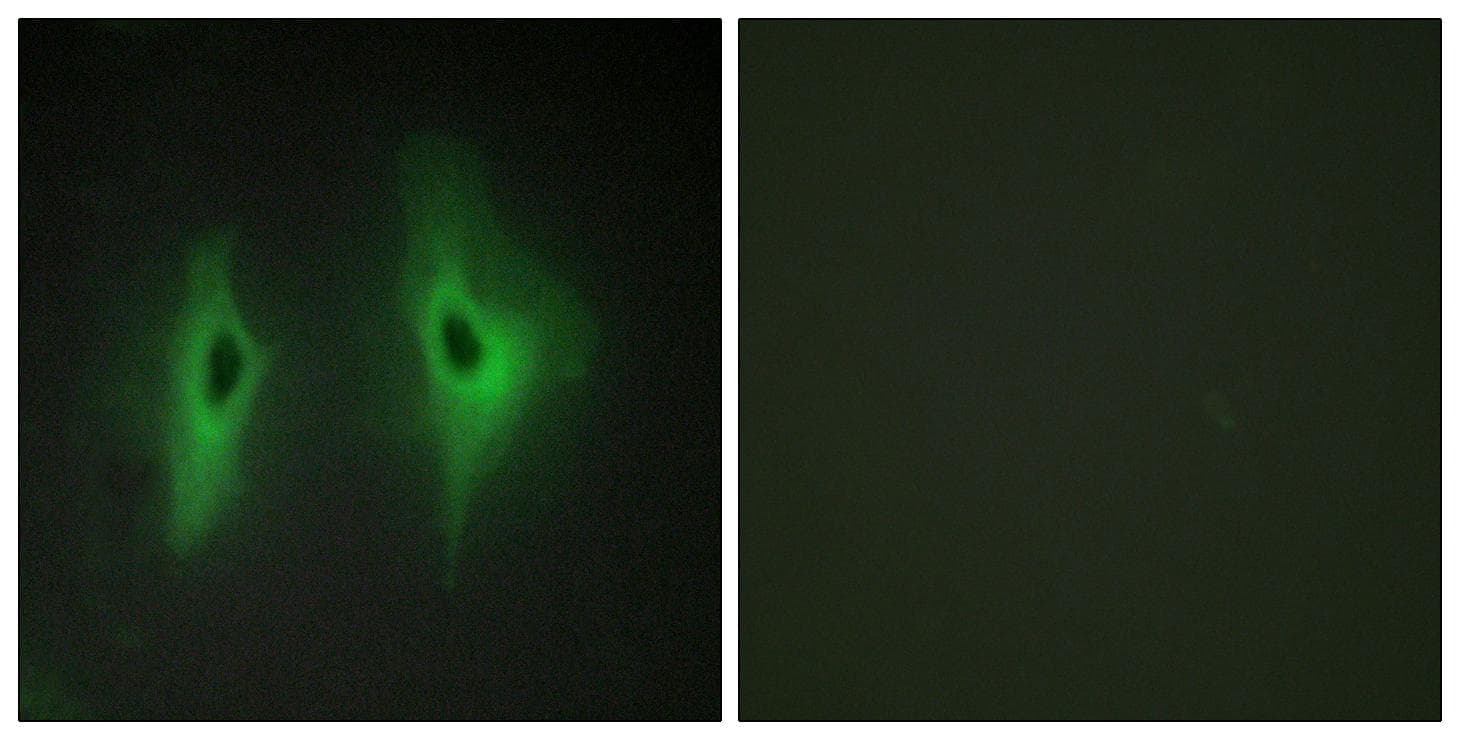 DGKeta / DGKH Antibody