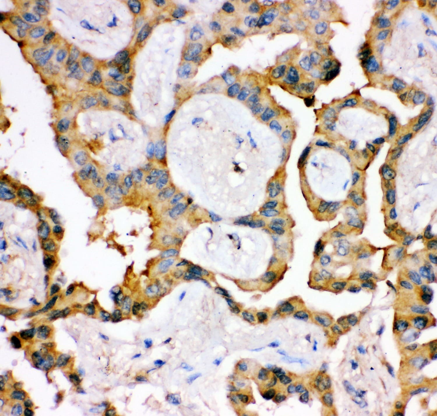 IRS1 Antibody (aa1041-1242)