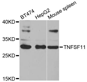TNFSF11 / RANKL / TRANCE Antibody