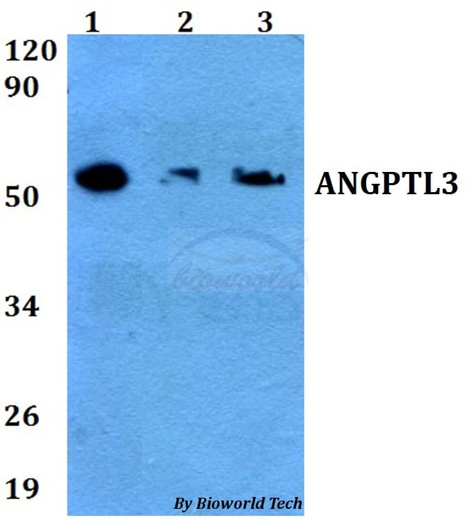 Polyclonal Rabbit anti-Human ANGPTL3 Antibody (WB)