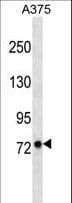 Polyclonal Rabbit anti-Human LRFN2 Antibody (aa630-659, WB)