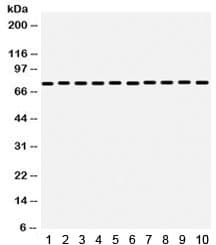 Polyclonal Rabbit anti-Human HSPA9 / Mortalin / GRP75 Antibody (IHC, WB)