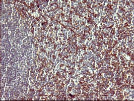 PAP2a / PPAP2A Antibody (clone OTI1H4)