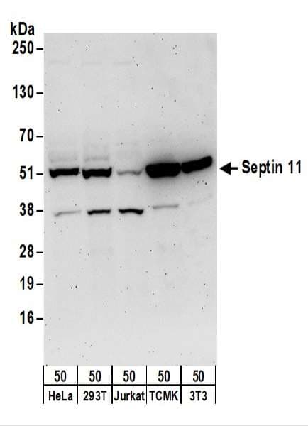 Polyclonal Rabbit anti-Human SEPT11 / Septin 11 Antibody (aa1-50, WB)