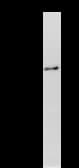 Monoclonal Mouse anti-Human MARS Antibody (clone MARSD10B4, IF, WB)