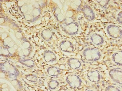 SPIC Antibody