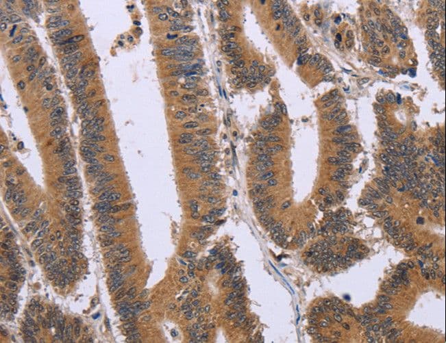FAM3B Antibody