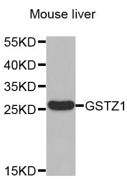 GSTZ1 Antibody