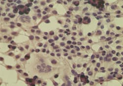 Polyclonal Rabbit anti-Human CYLD Antibody (aa32-45, WB)