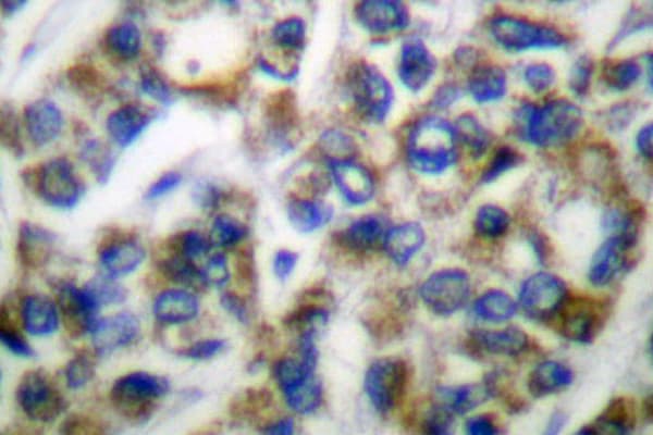 HSPA9 / Mortalin / GRP75 Antibody (Ser664)