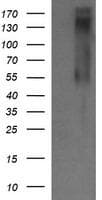 ERBB2 / HER2 Antibody (aa676-1255, clone OTI5C3, Carrier-free)