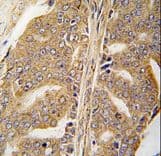 PXN / Paxillin Antibody (Tyr118)