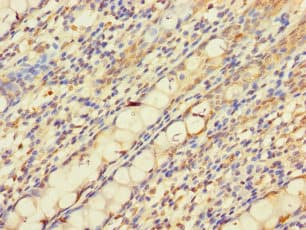 PNPLA2 / ATGL Antibody