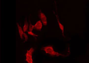 CYP2W1 Antibody
